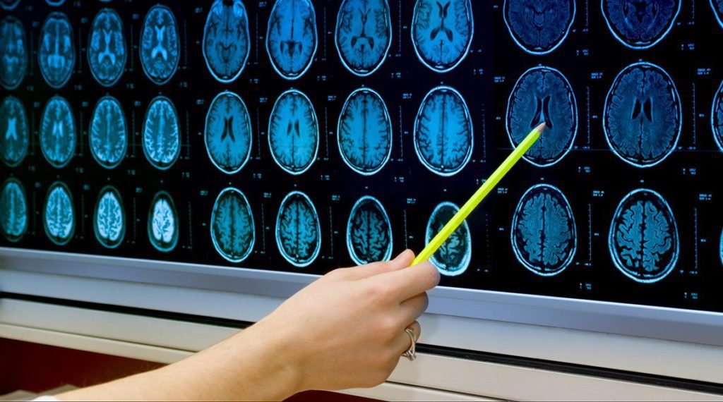 Newport Academy Mental Health Resources Teen Social Media Addiction Impacts Adolescent Brain